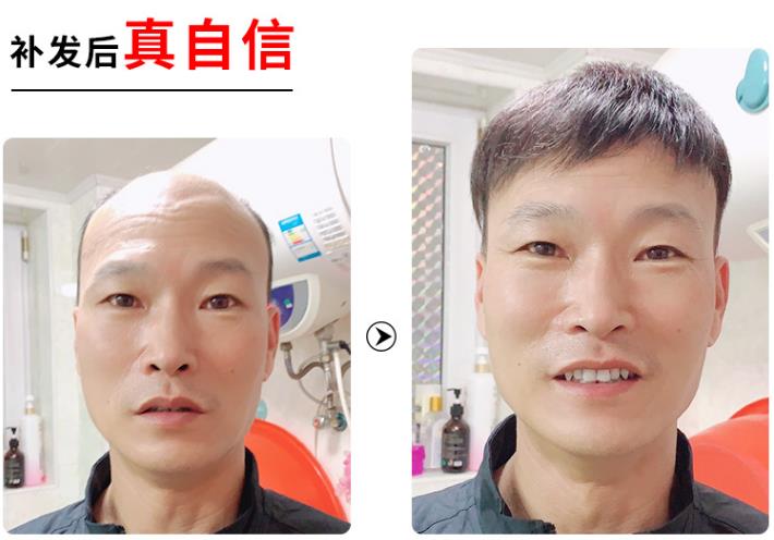 南阳增发补发