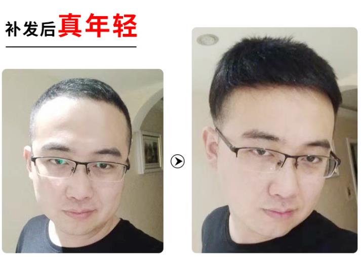 南阳增发补发