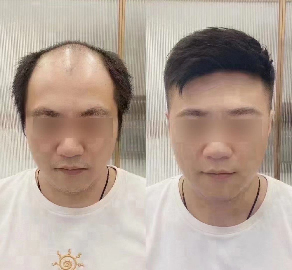 南阳假发定制，客户满意度高，性价比高