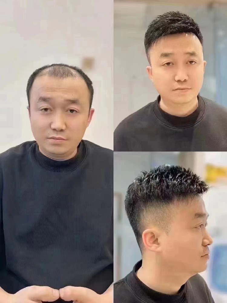 神奇的头发 “回归” 之旅