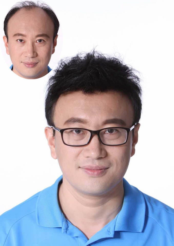 南阳假发定制，神奇增发技术看上去逼真自然