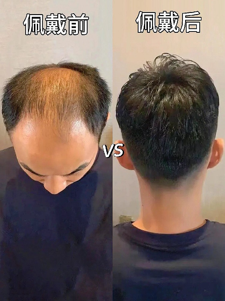 　南阳男士假发
