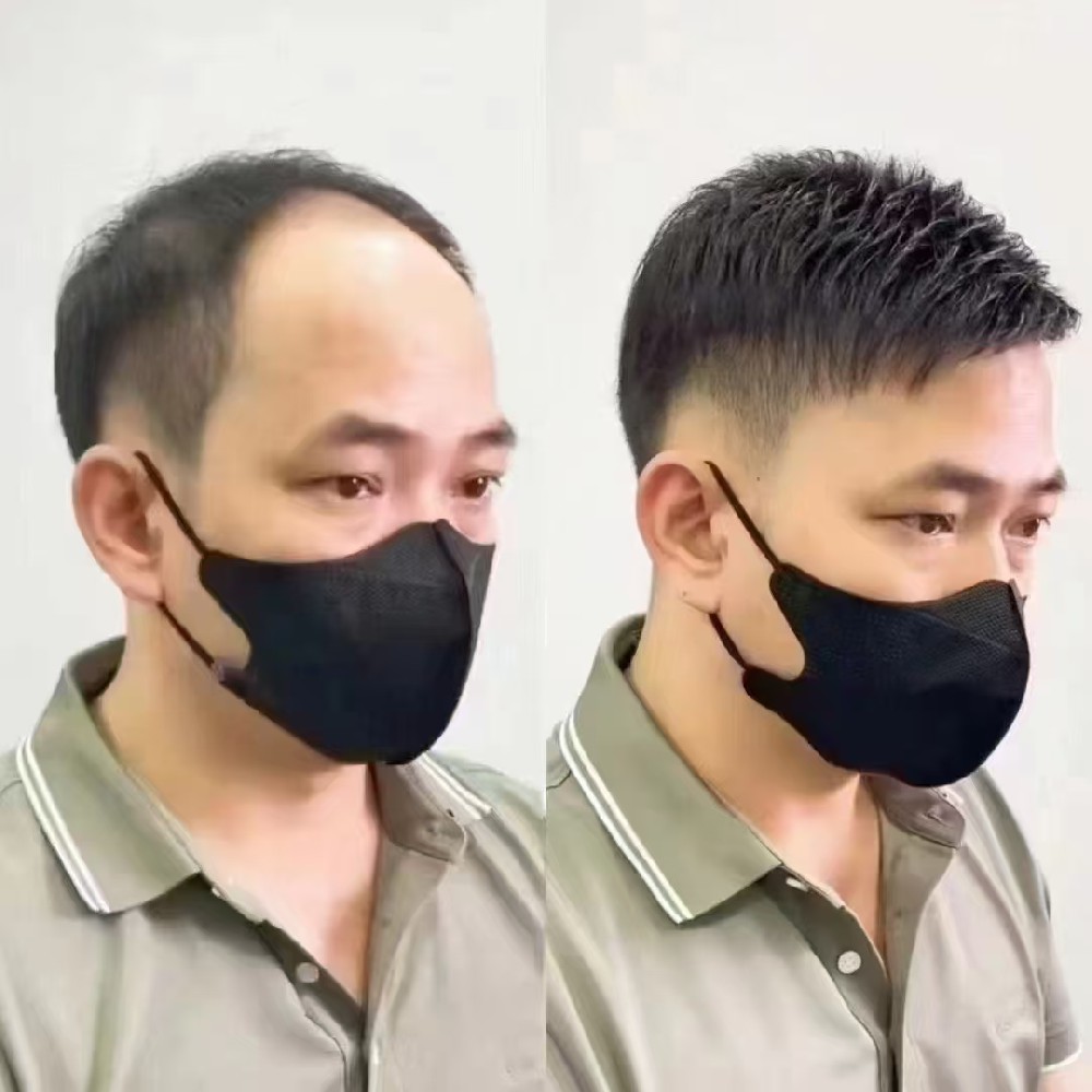 南阳假发增发后，你已帅到了一种让我不可仰望的高度！