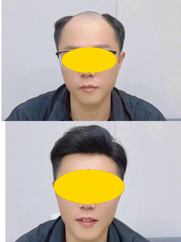 自从去了这家南阳男士假发店，沧桑大叔年龄从此保持年轻态