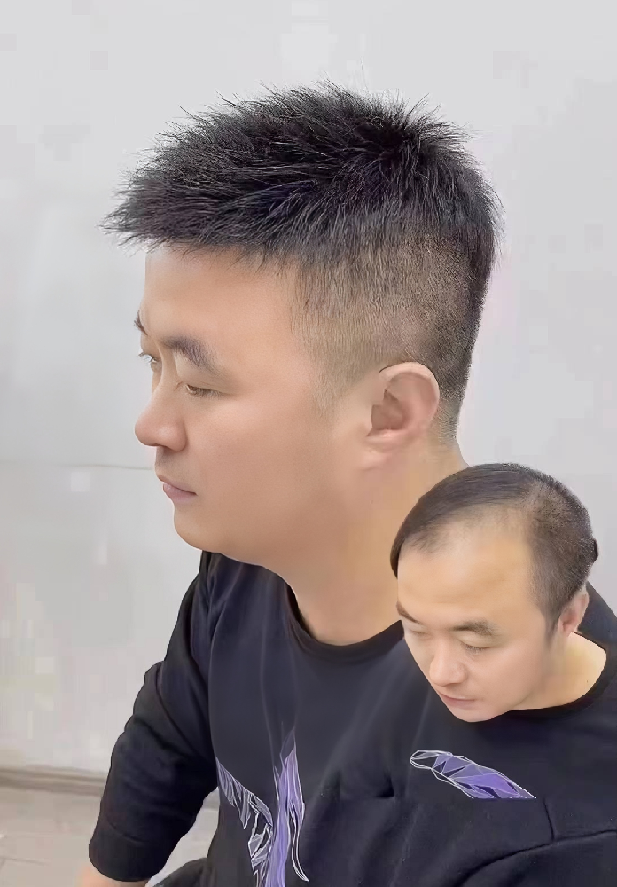 南阳假发真的能改变我的脱发形象吗？