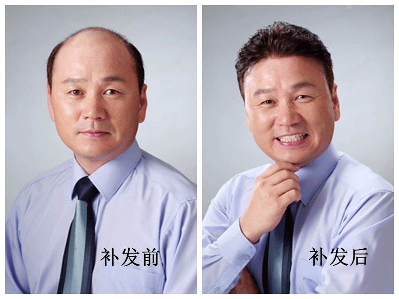 南阳中老年全真发定制假发：让时光倒流，重拾岁月自信