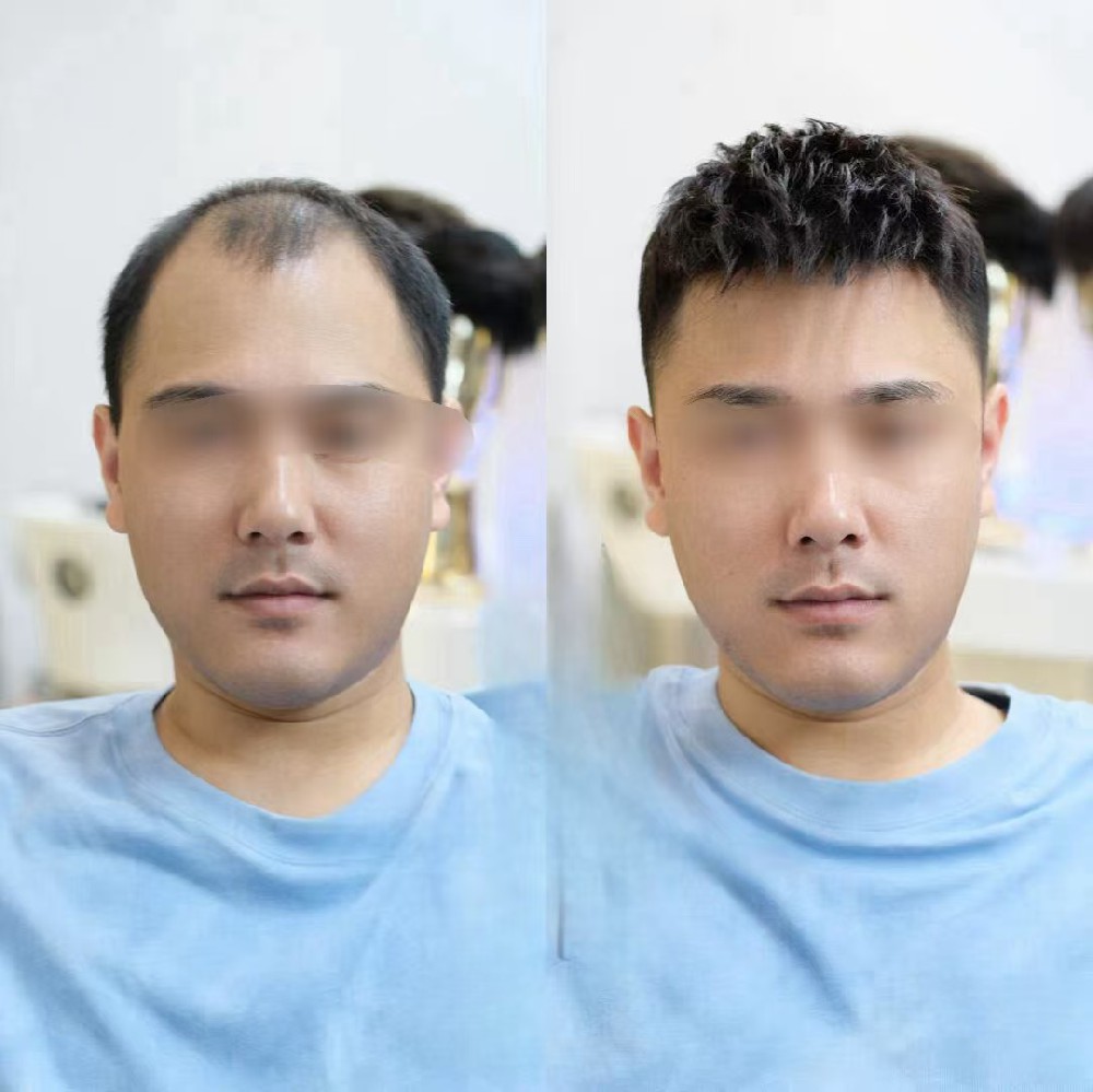 南阳千丝美假发定制温馨提醒：没有好头发，哪来好人生？