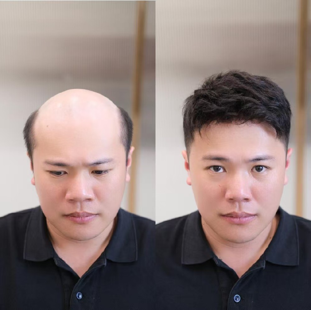 　　南阳中老年假发
