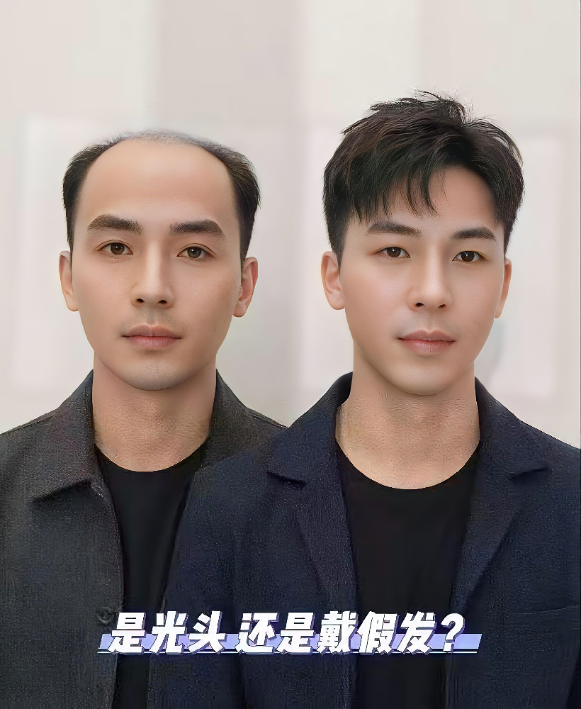 好形象拥抱新生活，千丝美助力脱发新青年！