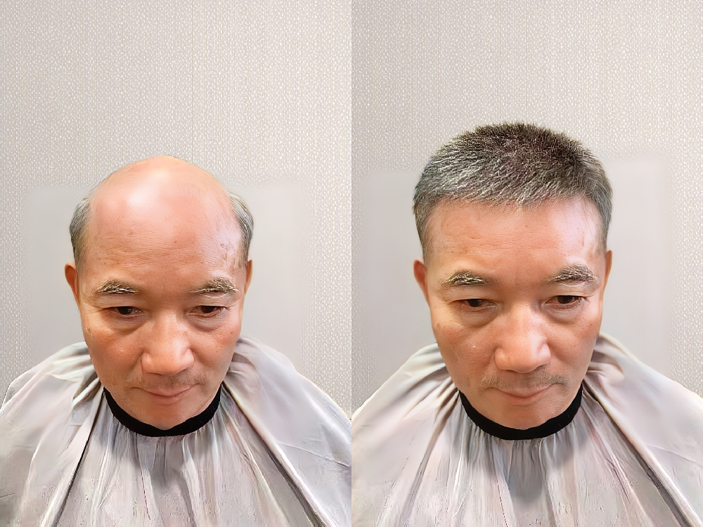老年男士的“第二春”：超薄假发让秃顶大叔秒变精神小伙！