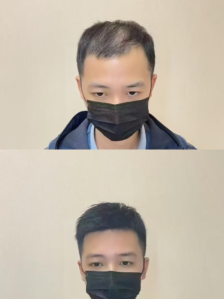 一顶假发逆天改命，年轻十岁不是梦！