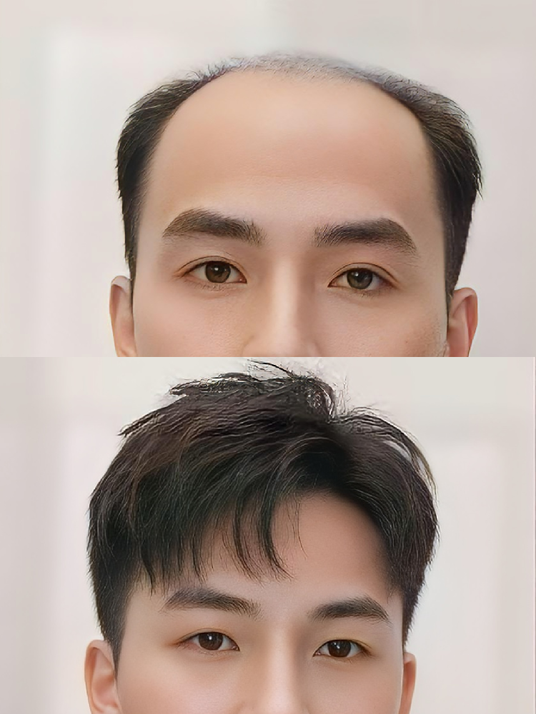 来千丝美增发，让头发再次成为青春的代言