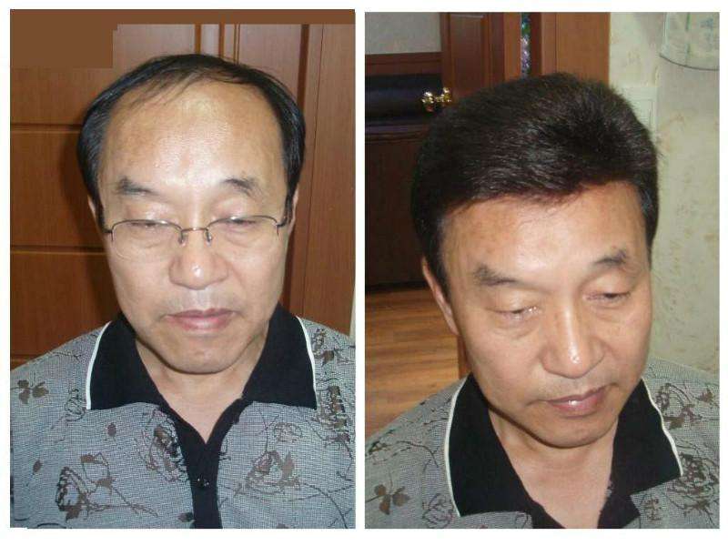 老年男补发.jpg