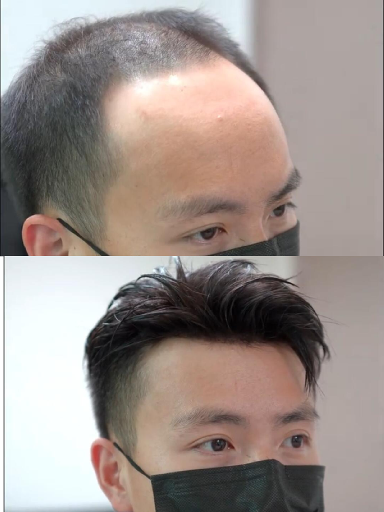 南阳男士补发假发定制，让你拥有理想发型。