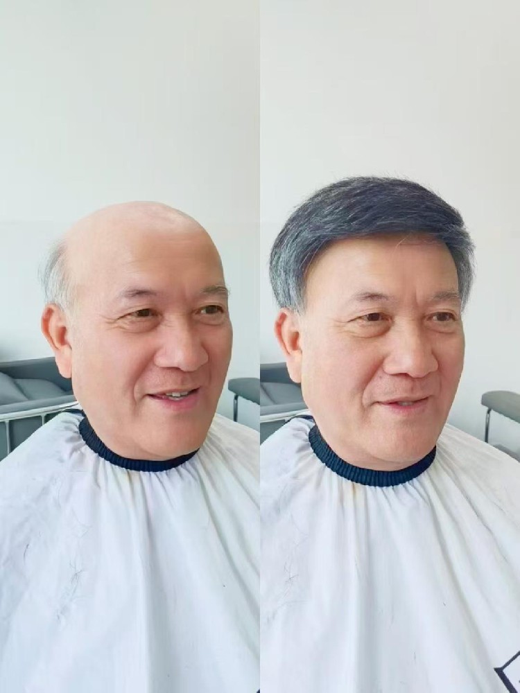 南阳男士假发