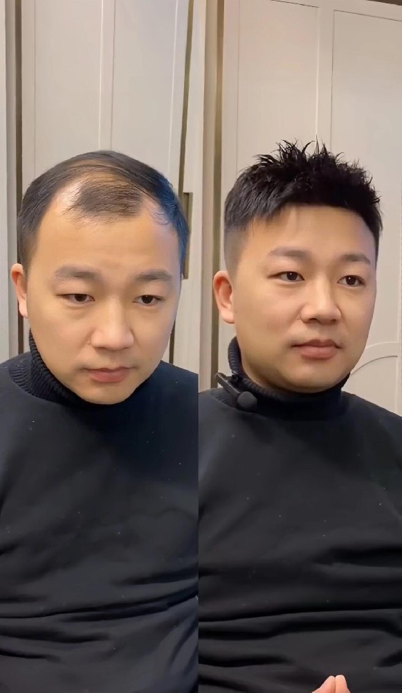南阳高档假发