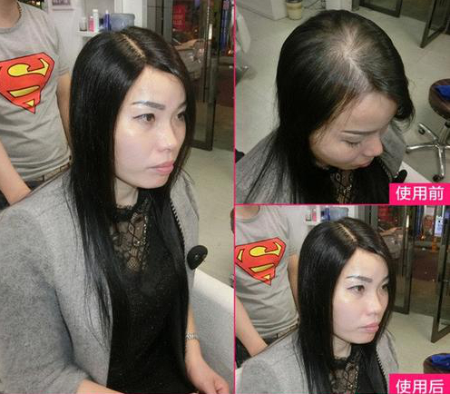 南阳假发定制：可随意造型的时尚女士假发，让你秒变女神