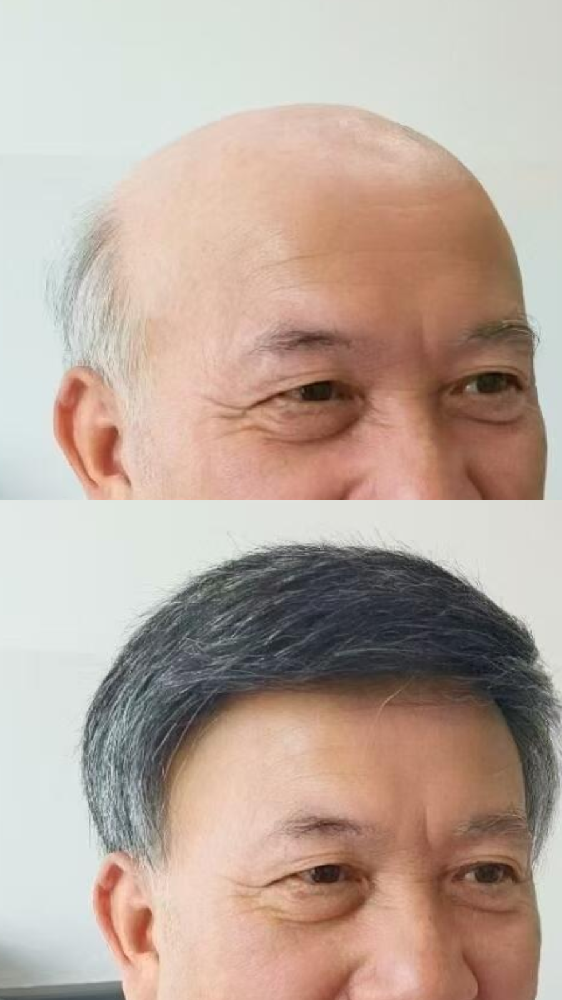 男士形象重塑：南阳定制假发的关键作用与南阳专业推荐