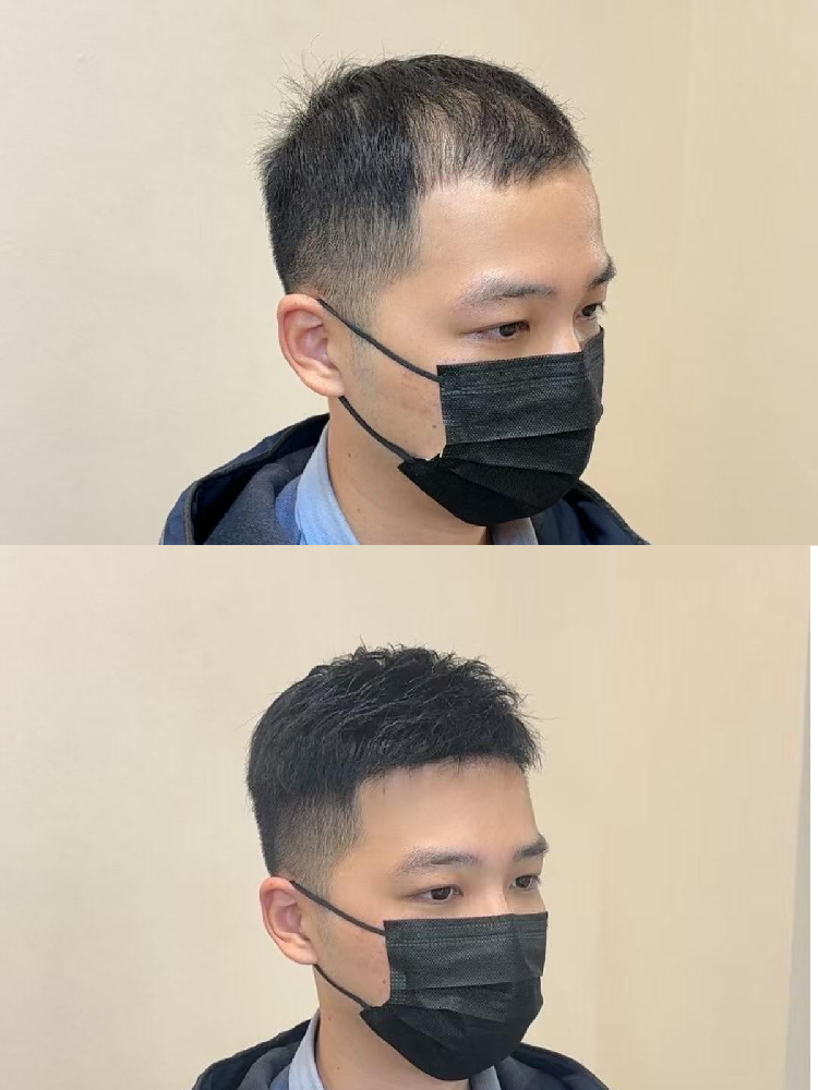 南阳男士定制门店在哪里？变年轻就这么简单