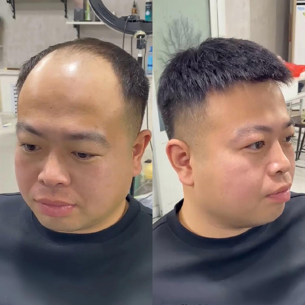 南阳假发：为您量身定制的自信选择