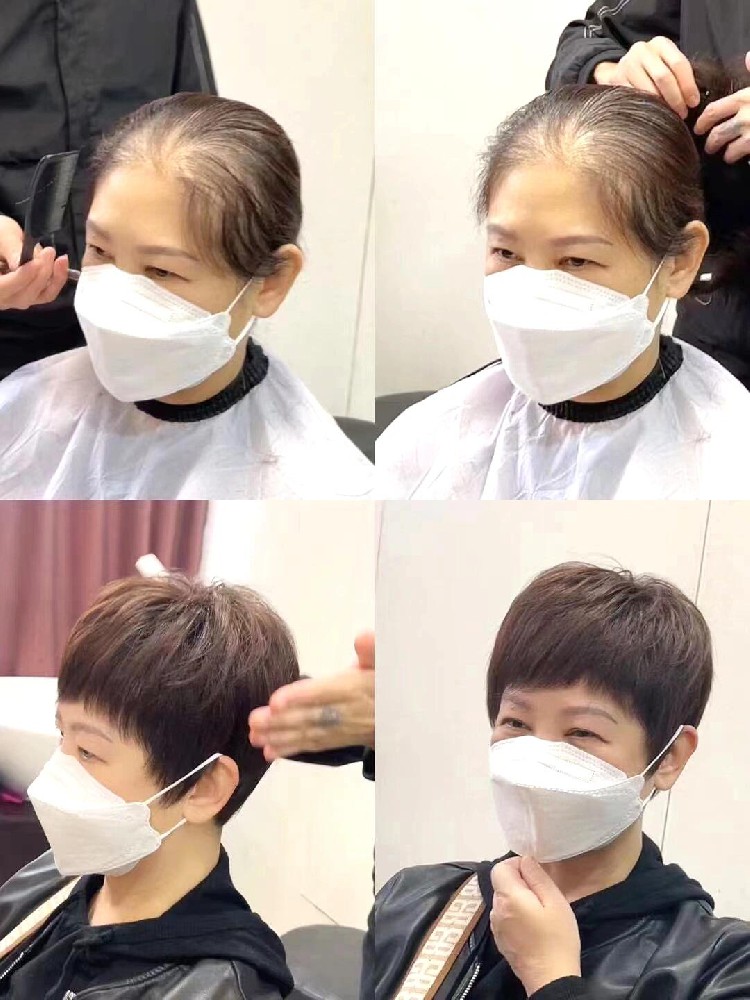 南阳千丝美补发假发定制中心：烫发损伤秀发？不如用专业补发找回自信与美丽
