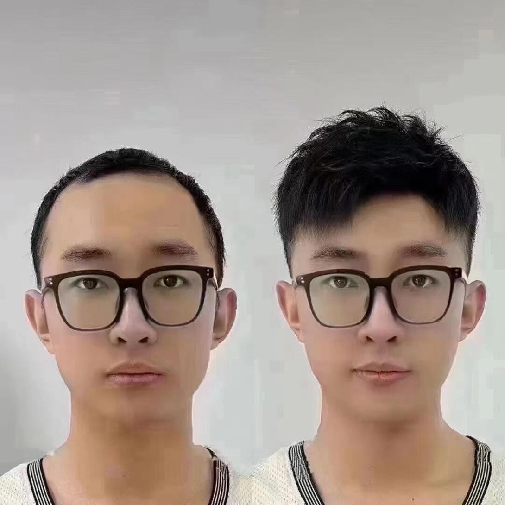 南阳男士头顶稀疏怎么办？这个方法让他们快速找回自信