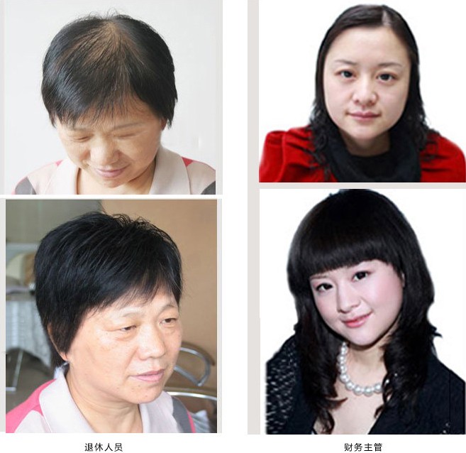 南阳千丝美假发定制，为女性白发解忧