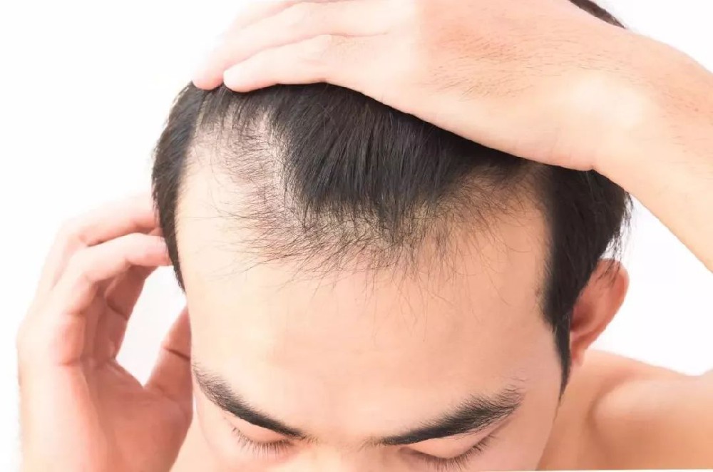 南阳千丝美定制假发：自然遮盖，重拾清爽自信