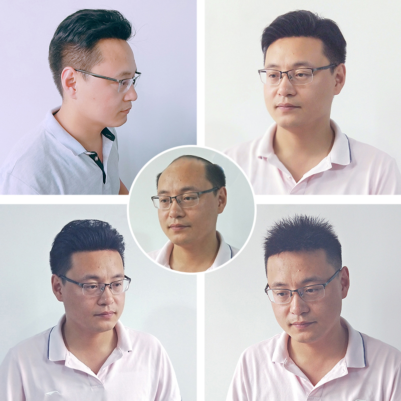 南阳脱发不用愁，千丝美定制假发帮你重拾自信