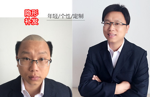南阳假发怎么选？千丝美用16年经验告诉你：选对地方，头发就回来了