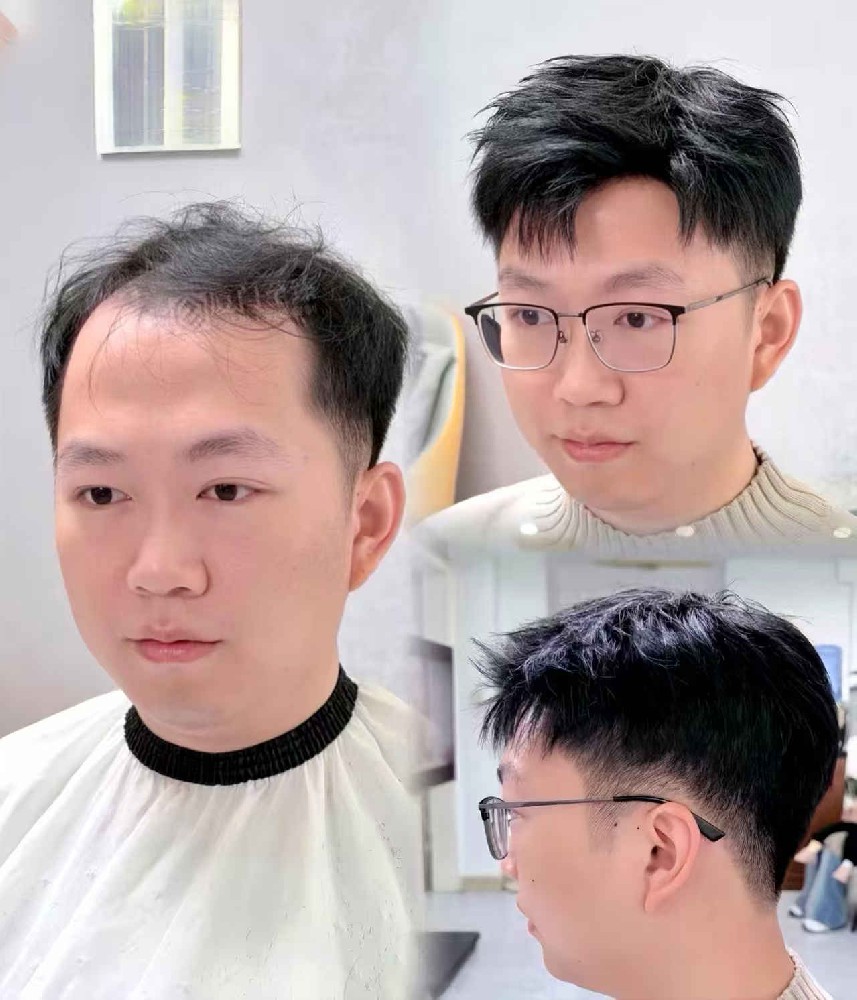 南阳男士脱发相亲难？地中海秃顶也能做清爽小平头｜南阳假发定制