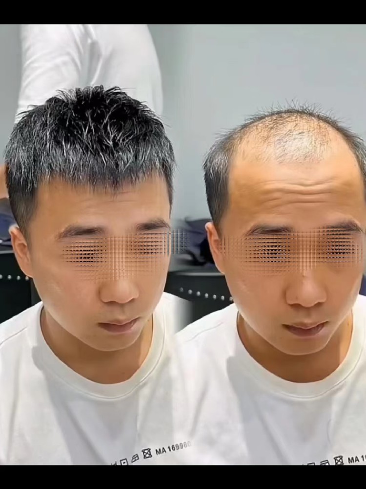 南阳女士假发：2小时，她从“不敢照镜子”到连拍十张自拍