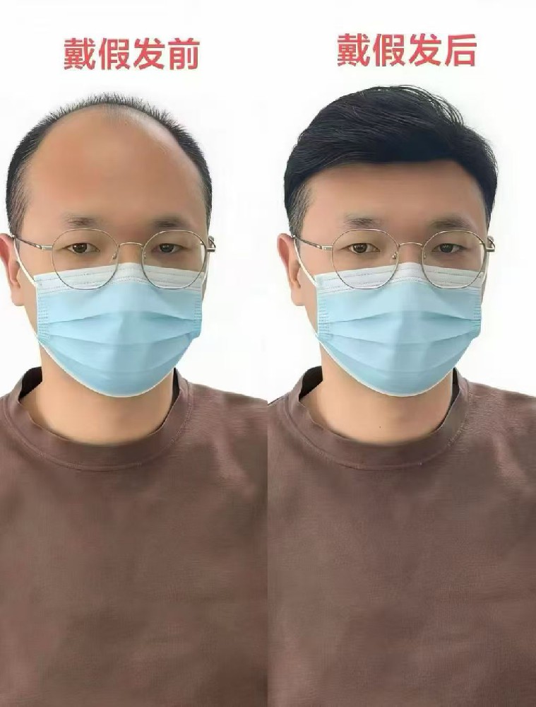本地人的心声：与其等毛囊“复活”，不如来了解这场精细的假发定制革命