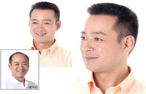 南阳假发定制：从“头”开始的自信，无痕补发让你告别脱发焦虑