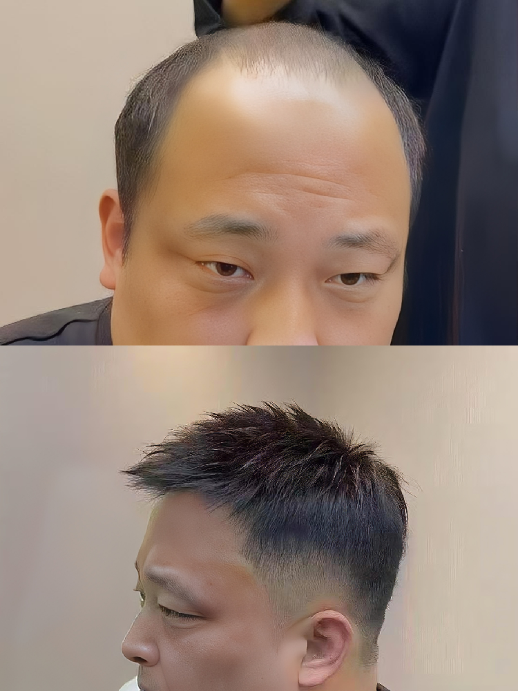 南阳假发定制哪家靠谱?千丝美深耕本地 专业物理补发自然无痕 南阳假发定制哪家靠谱?千丝美深耕本地 专业物理补发自然无痕