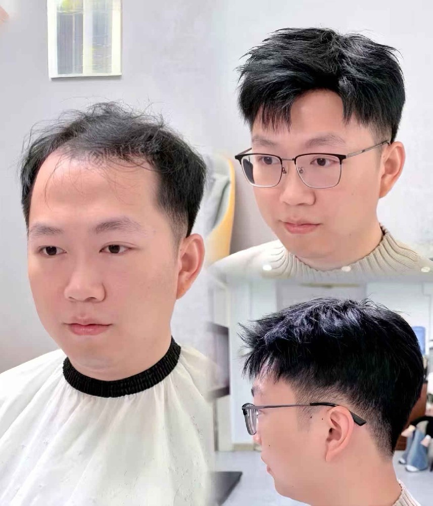 南阳千丝美假发定制：重塑年轻自信，告别脱发与白发困扰