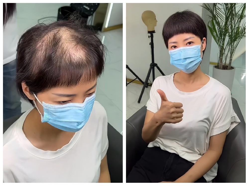南阳假发 南阳女士假发 南阳男士假发 推荐南阳千丝美补发假发定制中心